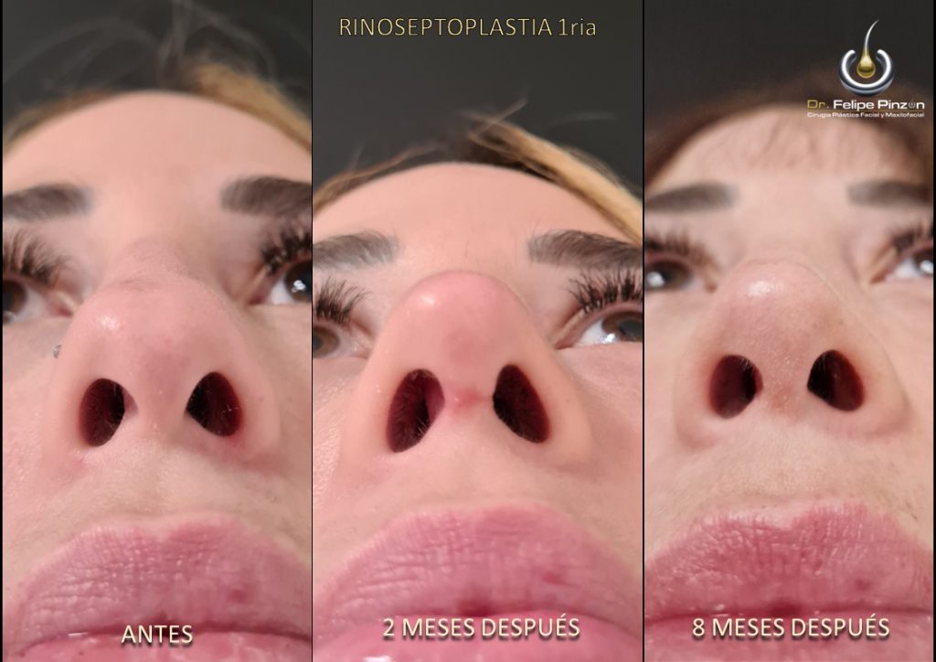 imagen-galeria-61