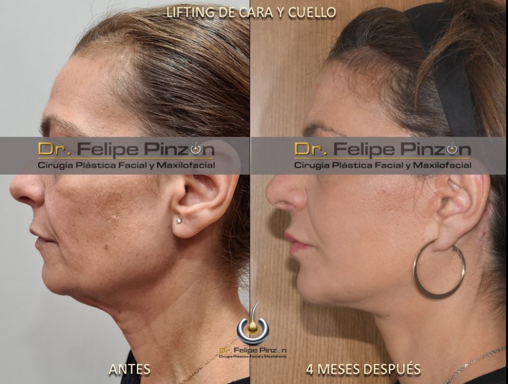 imagen-galeria-16